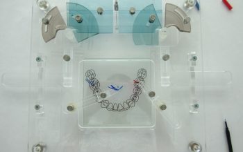 lighthouse dental dentysta stomatolog szczecin dominika polak joanna serewa bruksizm